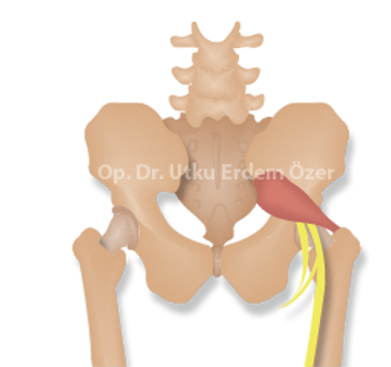 piriformis sendromu