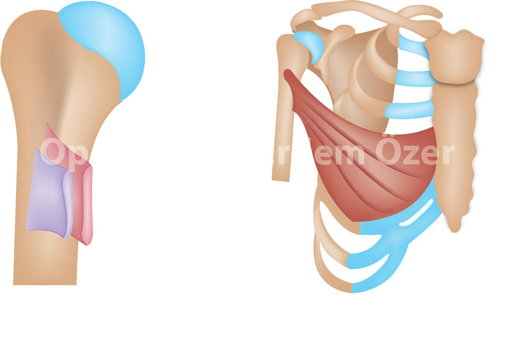 pektoral major yırtığı