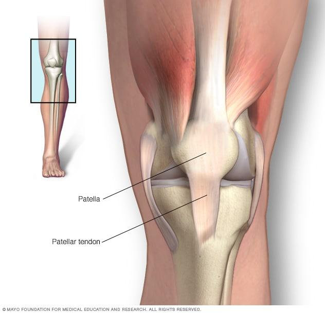 Patellar Tendinit Ağrısı Nasıl Geçer?