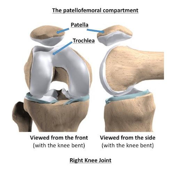 kondromalazi patella nedir